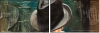 25062191
