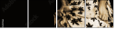 35392166