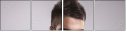 56809198